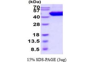 SDS-PAGE (SDS) image for Interleukin 5 Receptor, alpha (IL5RA) (AA 18-339) protein (His tag) (ABIN5854571)