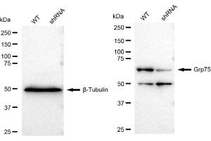 Western blotting analysis using Grp75 antibody (ABIN7798860). (Recombinant HSPA9 anticorps)