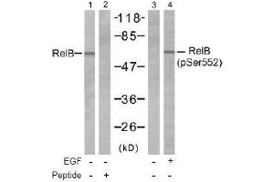 Image no. 1 for anti-V-Rel Reticuloendotheliosis Viral Oncogene Homolog B (RELB) (pSer552) antibody (ABIN197017) (RELB anticorps  (pSer552))