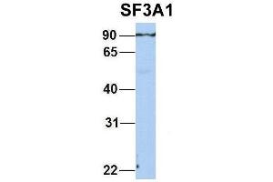Host:  Rabbit  Target Name:  SF3A1  Sample Type:  Human Adult Placenta  Antibody Dilution:  1. (SF3A1 anticorps  (N-Term))