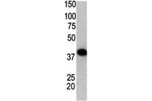 Western blot using SUMO2 antibody and GST-SUMO2 fusion protein. (SUMO2 anticorps  (AA 63-93))