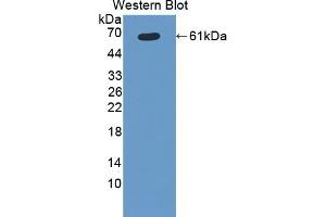 Detection of Recombinant CYP11B1, Rat using Polyclonal Antibody to Cytochrome P450 11B1 (CYP11B1) (CYP11B1 anticorps  (AA 1-498))