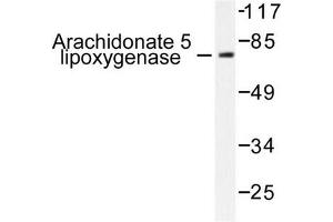 Image no. 1 for anti-Arachidonate 5-Lipoxygenase (ALOX5) antibody (ABIN271992) (ALOX5 anticorps)