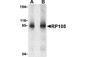 Western blot analysis of RP105 in human spleen tissue lysate with RP105 antibody at (A) 0. (CD180 anticorps  (N-Term))