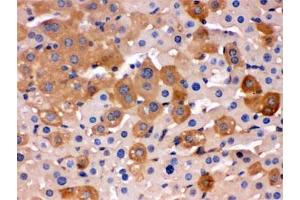 IHC testing of FFPE mouse liver with Transferrin antibody. (Transferrin anticorps)