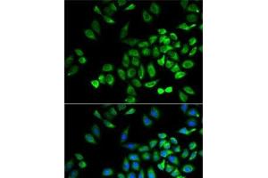 Immunofluorescence analysis of A-549 cells using ANGPTL4 Polyclonal Antibody (ANGPTL4 anticorps)
