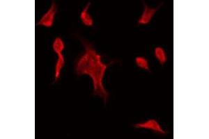 ABIN6275528 staining Hela by IF/ICC.