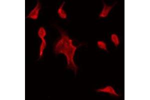 ABIN6275528 staining Hela by IF/ICC. (STK32C anticorps  (Internal Region))
