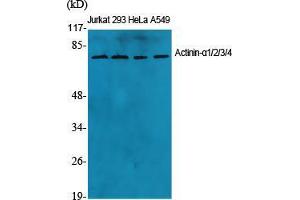 Western Blot (WB) analysis of specific cells using Actinin-alpha1/2/3/4 Polyclonal Antibody.