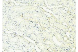 ABIN6276965 at 1/100 staining Mouse kidney tissue by IHC-P.