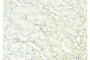 ABIN6276965 at 1/100 staining Mouse kidney tissue by IHC-P. (RAB27A anticorps  (C-Term))
