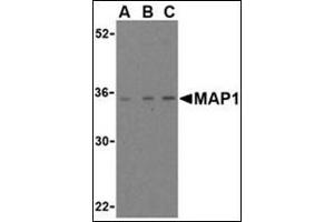Western blot analysis of MAP-1 in EL4 cell lysate with this product at (A) 1, (B) 2, and (C) 4 μg/ml (MOAP1 anticorps  (Center))