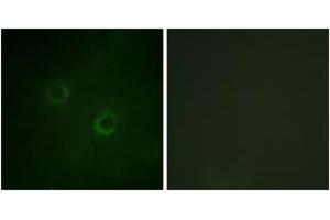 Immunofluorescence analysis of COS7 cells, using Lck (Ab-192) Antibody. (LCK anticorps  (AA 161-210))