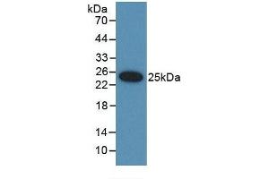 Detection of Recombinant UBD, Rat using Polyclonal Antibody to Ubiquitin D (UBD) (UBD anticorps  (AA 1-155))
