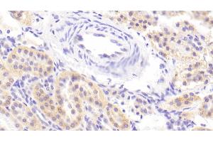 anti-Integrin alpha 2 (ITGA2) (AA 74-277) antibody