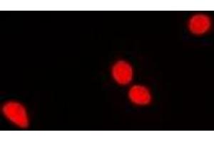 Immunofluorescent analysis of RNGTT staining in MCF7 cells. (RNGTT anticorps)