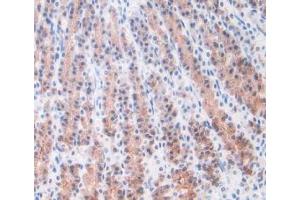 IHC-P analysis of Rat Stomach Tissue, with DAB staining. (ORM1 anticorps  (AA 19-186))