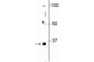 Western blot of neonatal rat brain lysate showing specific immunolabeling of the ~32 kDa Olig2 protein. (OLIG2 anticorps)