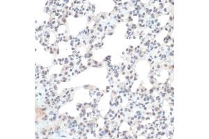 Immunohistochemistry of paraffin-embedded Rat lung using Thioredoxin 1 (Trx1/Thioredoxin 1 (Trx1/TXN)) antibody (ABIN7270798) at dilution of 1:100 (40x lens). (TXN anticorps  (C-Term))
