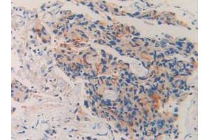 Detection of CD10 in Human Prostate Gland Tissue using Polyclonal Antibody to Neprilysin (CD10)