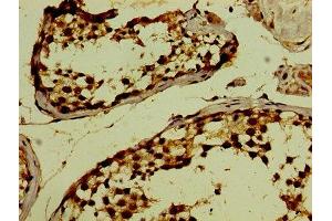 Immunohistochemistry of paraffin-embedded human testis tissue using ABIN7163056 at dilution of 1:100 (PHF6 anticorps  (AA 2-312))