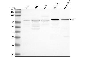 Western blot analysis of GBE1 using anti-GBE1 antibody (ABIN7602464).
