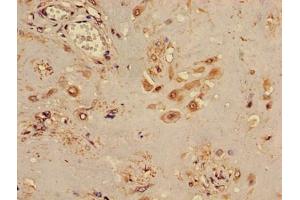 Immunohistochemistry of paraffin-embedded human placenta tissue using ABIN7171778 at dilution of 1:100 (TINF2 anticorps  (AA 210-451))