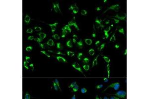 Immunofluorescence analysis of MCF-7 cells using CDKN3 Polyclonal Antibody (CDKN3 anticorps)