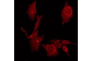 ABIN6275370 staining Hela by IF/ICC.