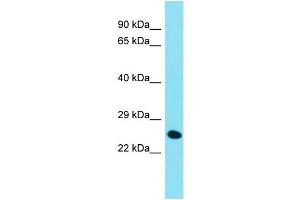 Host: Rabbit  Target Name: Chmp4c  Sample Tissue: Mouse Liver lysates  Antibody Dilution: 1. (CHMP4C anticorps  (C-Term))