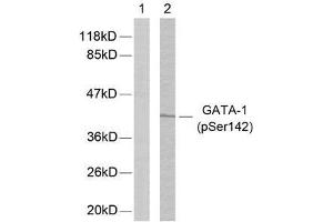 Western blot analysis of extracts from K562 cells using GATA-1 (phospho-Ser142) antibody (E011041). (GATA1 anticorps  (pSer142))