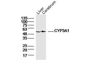 Lane 1: Rat Liver lysates Lane 2: Rat Cerebrum lysates probed with CYP3A1 Polyclonal Antibody, Unconjugated  at 1:300 dilution and 4˚C overnight incubation. (CYP3A1 anticorps  (AA 231-330))
