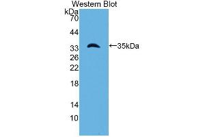 Western blot analysis of the recombinant protein. (Laminin gamma 1 anticorps  (AA 1283-1551))