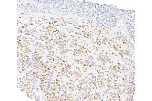 Immunohistochemistry (IHC) image for anti-RNA Polymerase II (pSer5) antibody (ABIN7455032) (RNA Polymerase II anticorps  (pSer5))
