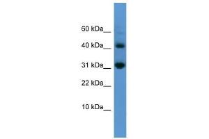 CASP7 antibody used at 0. (Caspase 7 anticorps  (N-Term))