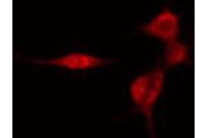 ABIN6274453 staining HeLa cells by IF/ICC. (SMG7 anticorps  (Internal Region))