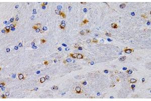 Immunohistochemistry of paraffin-embedded Mouse brain using TFF1 Polyclonal Antibody at dilution of 1:200 (40x lens).