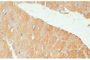 Immunohistochemistry of paraffin-embedded Mouse heart using MYBPC3 Polyclonal Antibody at dilution of 1:100 (40x lens). (MYBPC3 anticorps)