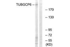 Western blot analysis of extracts from COLO cells, using TUBGCP6 Antibody.
