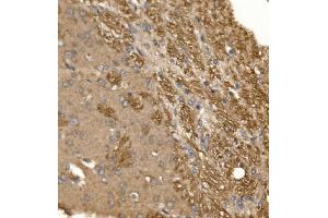 IHC analysis of Paxillin/PXN using anti-Paxillin/PXN antibody (ABIN7602636). (Paxillin anticorps  (AA 9-570))