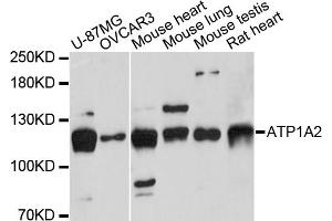 Western blot analysis of extracts of various cell lines, using ATP1A2 antibody (ABIN6291264) at 1:3000 dilution.
