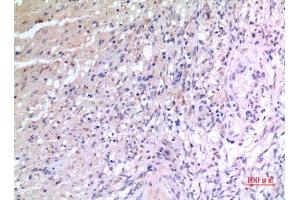Immunohistochemistry (IHC) analysis of paraffin-embedded Human Brain, antibody was diluted at 1:100.