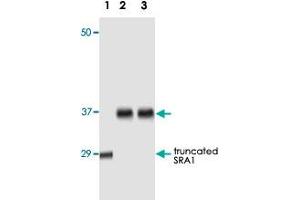 Western blot analysis using SRA1 monoclonal antibody, clone 1D4H8  against truncated SRA1 recombinant protein (1), human ovarian cancer tissue lysate (2) and A-431 cell lysate (3).