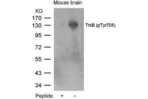Western blot analysis of extracts from mouse brain tissue using TrkB(Phospho-Tyr705) Antibody and the same antibody preincubated with blocking peptide. (TRKB anticorps  (pTyr705))