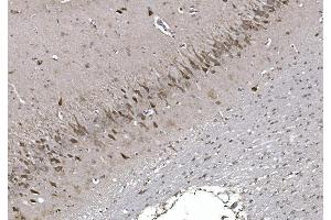 IHC analysis of CISD2 using anti-CISD2 antibody (ABIN7602010). (CISD2 anticorps  (AA 55-124))