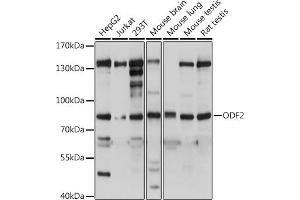 Western blot analysis of extracts of various cell lines, using ODF2 antibody (ABIN7269128) at dilution. (ODF2 anticorps  (AA 630-829))