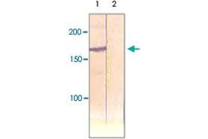 The cell lysate derived from insulin stimulated CHO was immunoprecipitated by IRS1 polyclonal antibody , then immunoprobed by the same antibody at 1 : 500 (Lane 1). (IRS1 anticorps)