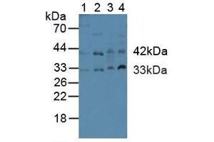 Western blot analysis of (1) Human Placenta Tissue, (2) Human HeLa cells, (3) Rat Heart Tissue and (4) Rat Uterus Tissue. (Caspase 9 anticorps  (AA 331-416))