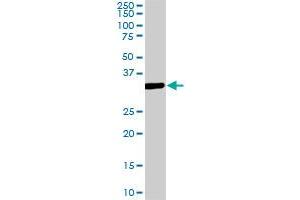 MEOX2 monoclonal antibody (M08), clone 5E1. (MEOX2 anticorps  (AA 1-303))