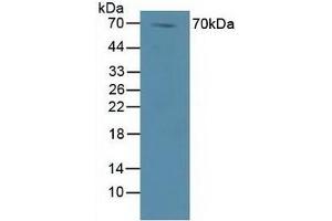 Detection of DVL1 in Human Lung Tissue using Polyclonal Antibody to Dishevelled, Dsh Homolog 1 (DVL1)